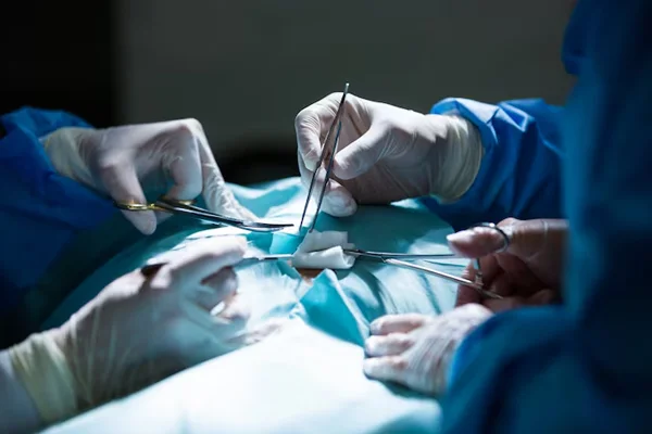 Minimally Invasive CABG